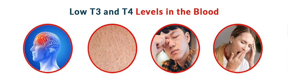 Low T3 and T4 Levels in the Blood